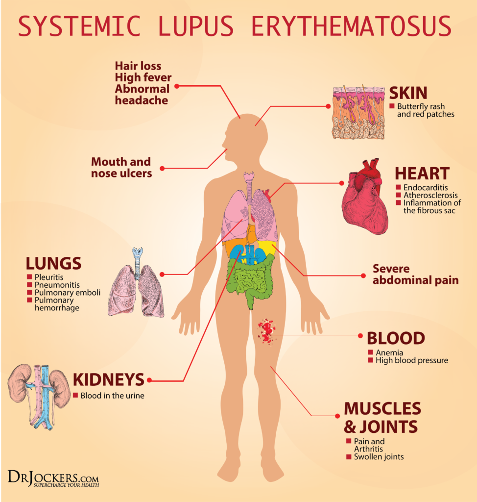 daily-lupus-awareness-fact-of-the-day